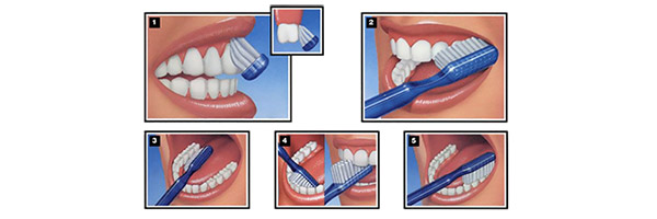 как чистить зубы правильно